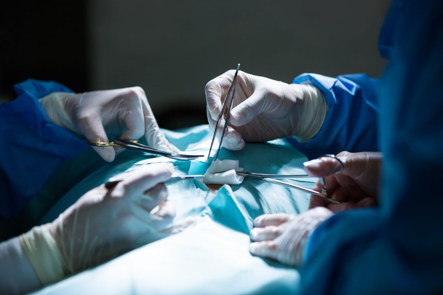 Especialistas en Cirugía por cáncer de útero y ovario en Cuautitlán y Tepotzotlán