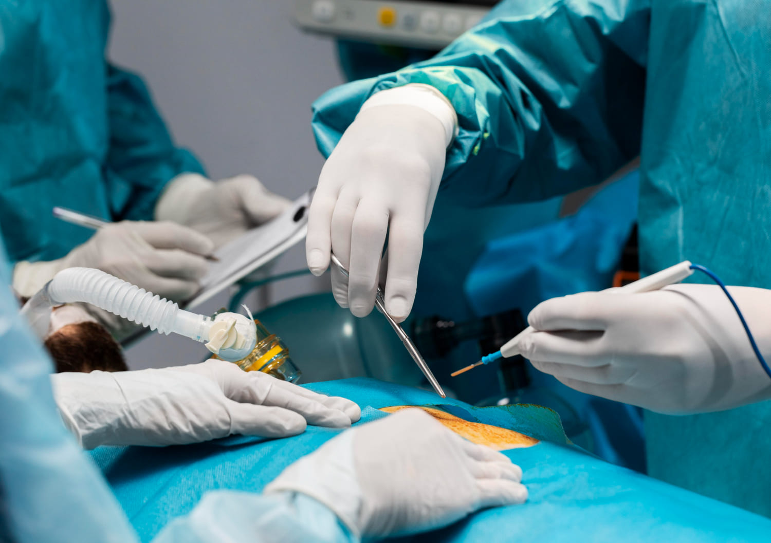 Cirugía por tumor de riñón y testículo en Cuautitlán y Tepotzotlán: Tratamiento Especializado